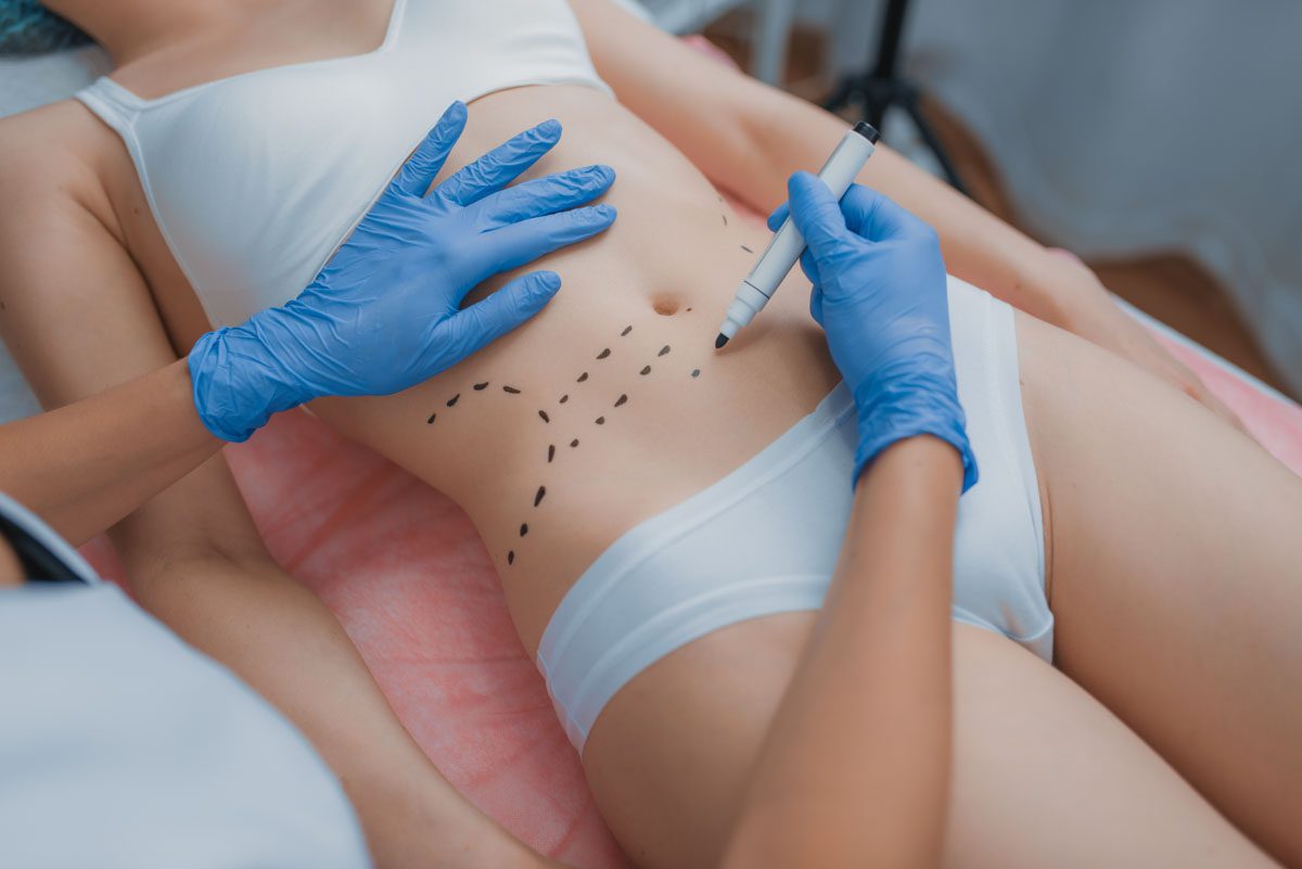 Auxiliar en Medicina Estética: especialización en el Quirófano
