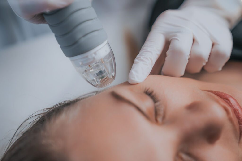 Dermapen: Tratamientos de Microneedling Facial y Corporal