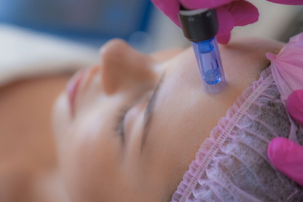 Dermapen: Tratamientos de Microneedling Facial y Corporal