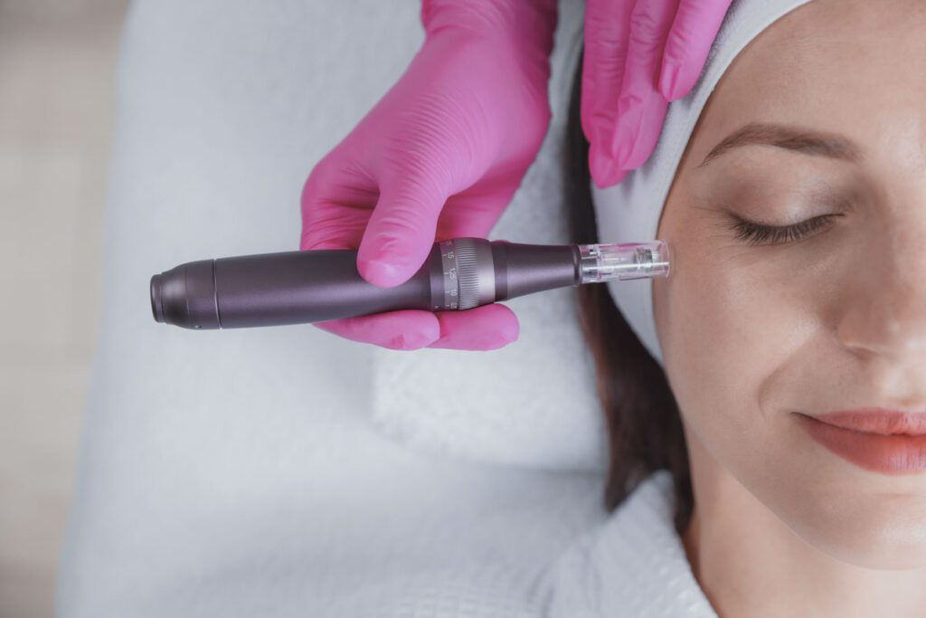 Dermapen: Tratamientos de Microneedling Facial y Corporal