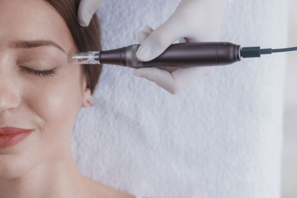 Dermapen: Tratamientos de Microneedling Facial y Corporal