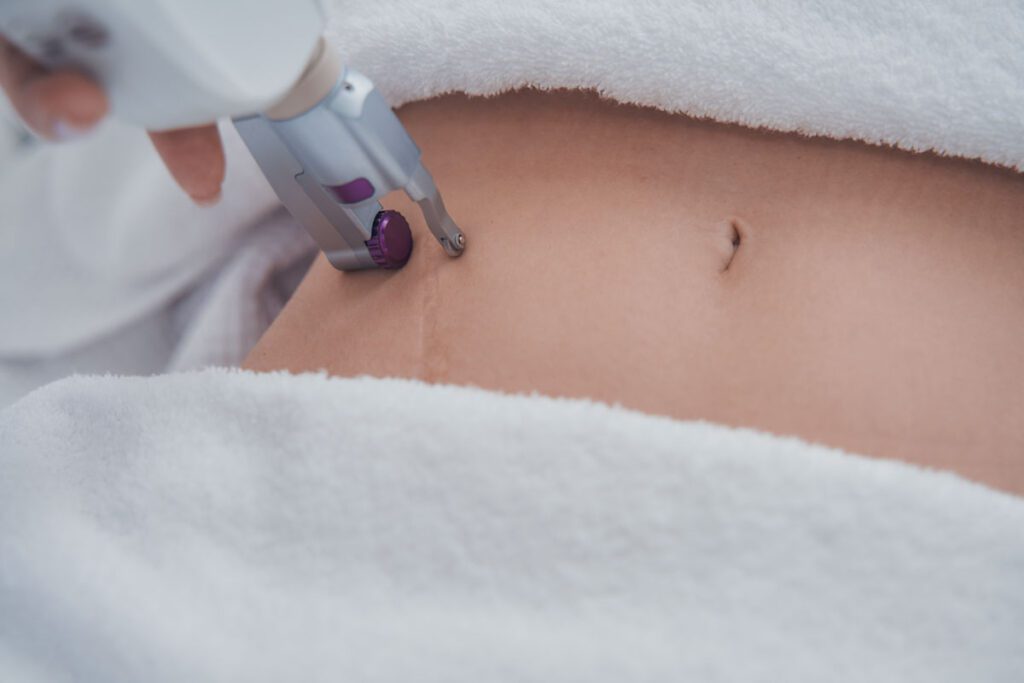 Especialista en Aparatología Corporal: mesoterapia, presoterapia y cavitación estética