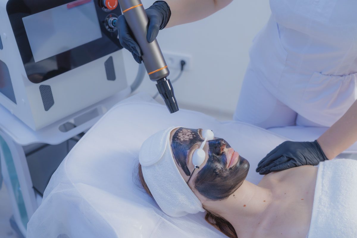 Hollywood Peel (Carbon Peel)