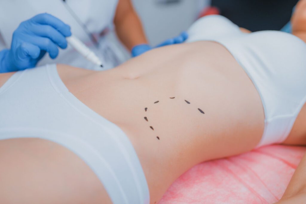 Auxiliar en Medicina Estética: especialización en el Quirófano