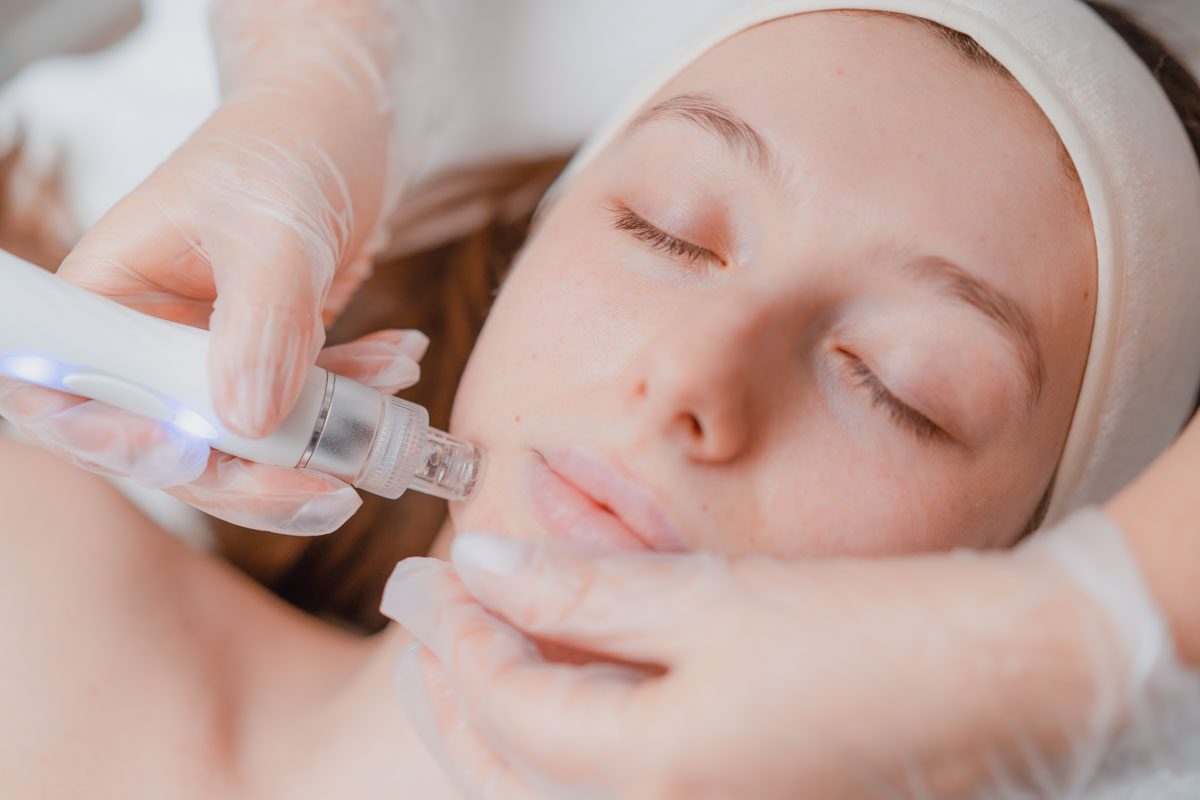 Dermapen: Tratamientos de Microneedling Facial y Corporal