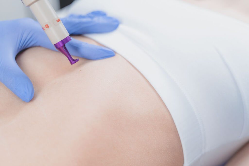 Especialista en Aparatología Corporal: mesoterapia, presoterapia y cavitación estética