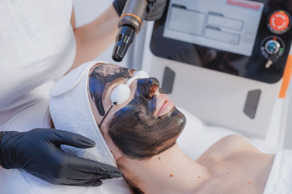 Hollywood Peel (Carbon Peel)