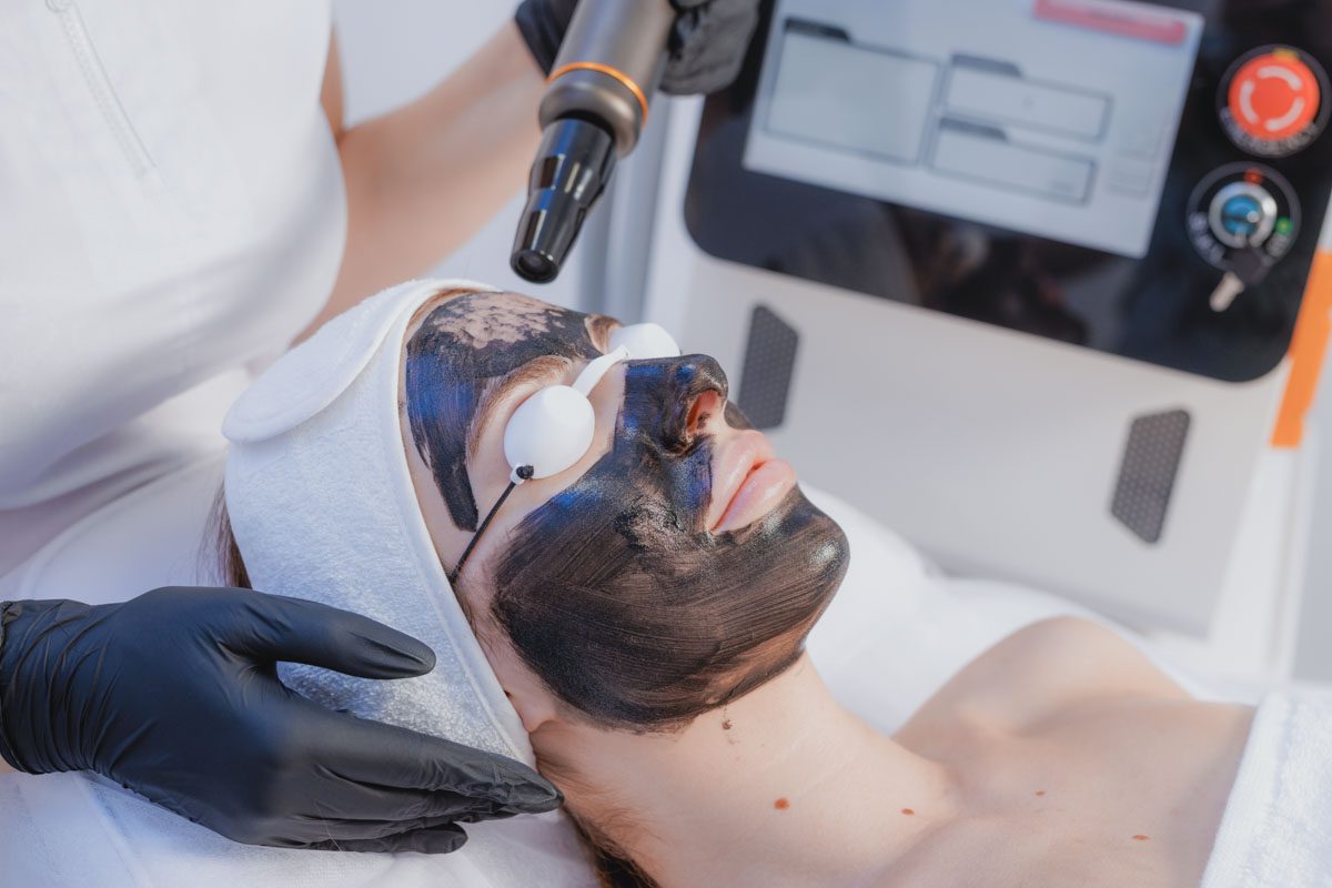 Hollywood Peel (Carbon Peel)