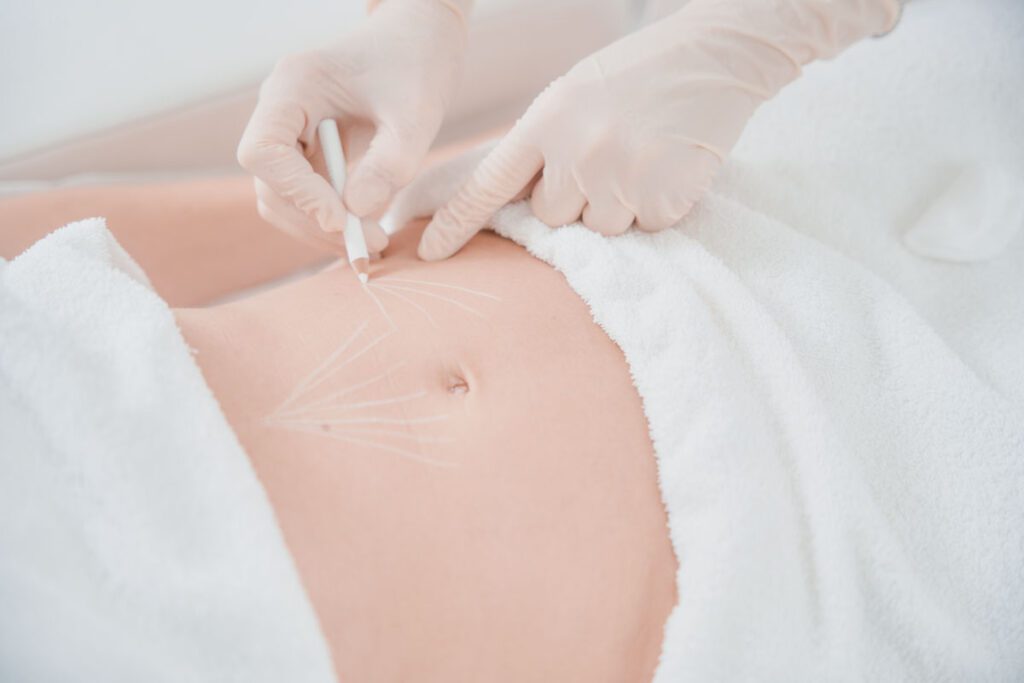 Auxiliar en Medicina Estética: especialización en el Quirófano