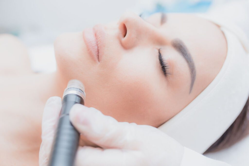 Dermapen: Tratamientos de Microneedling Facial y Corporal