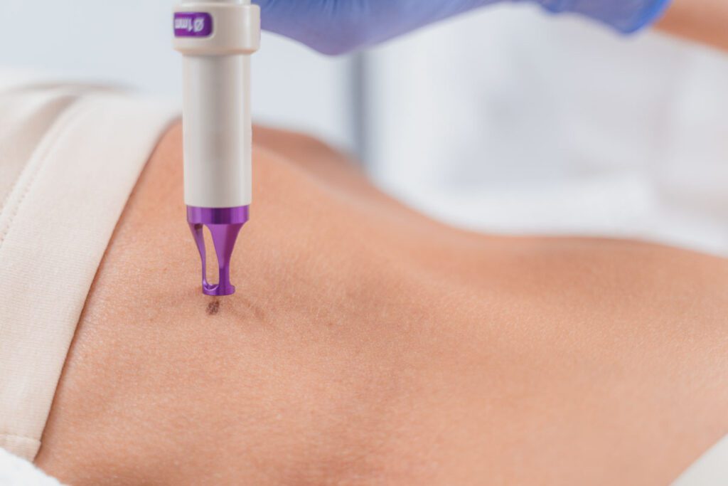 Especialista en Aparatología Corporal: mesoterapia, presoterapia y cavitación estética