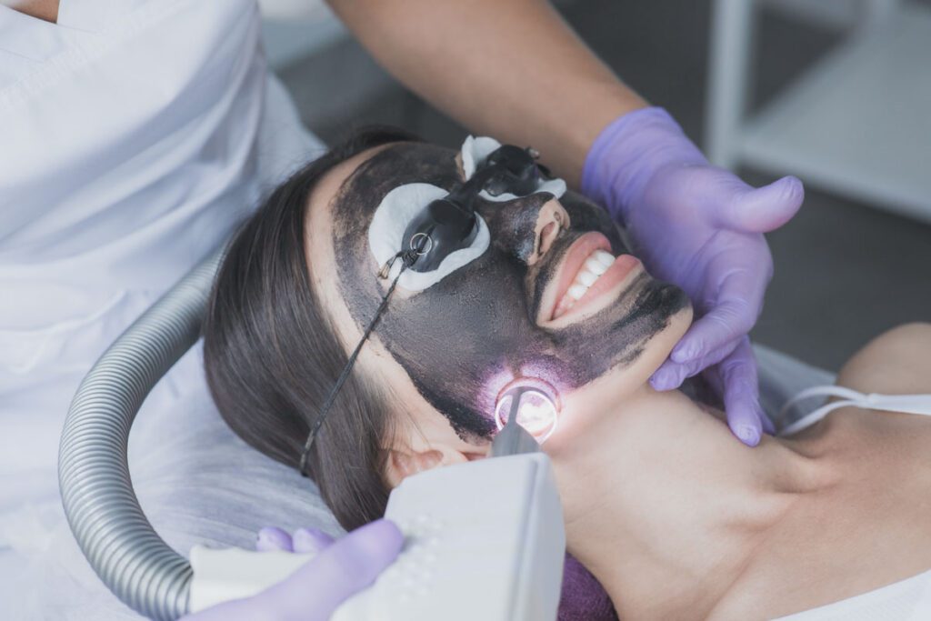 Hollywood Peel (Carbon Peel)